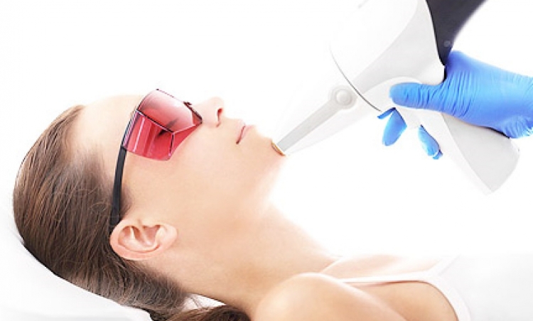 Depilacja laserowa – jak wybrać skuteczny laser?