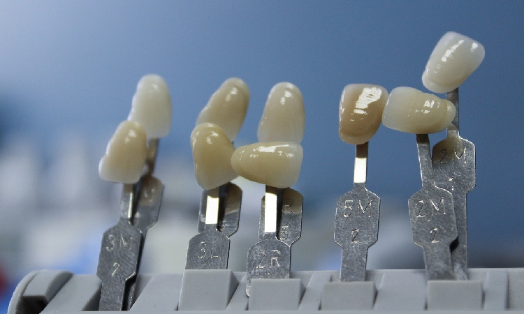 Implanty, korony zębowe i licówki