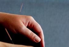 Acupuncture for Women for the duration of IVF Supports Women through Different Phases of IVF